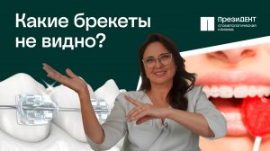 Керамические или металлические брекеты - какие лучше? 🔔 | Стоматология ПрезиДЕНТ 💚