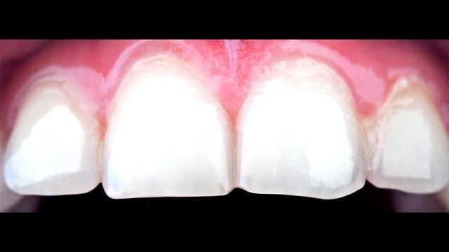 Идеальная улыбка :) Стоматологи врут! смотреть онлайн