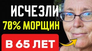 ЭТО УНИЧТОЖИТ 70% морщин ДАЖЕ В 65 лет