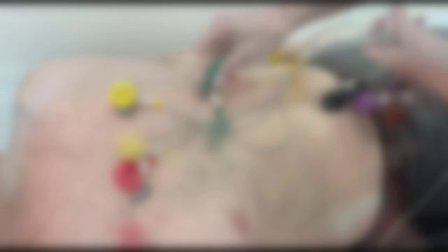 ЭКГ в Клинике семейная