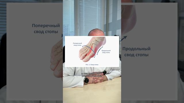 Продольное и поперечное плоскостопие – в чем отличия?