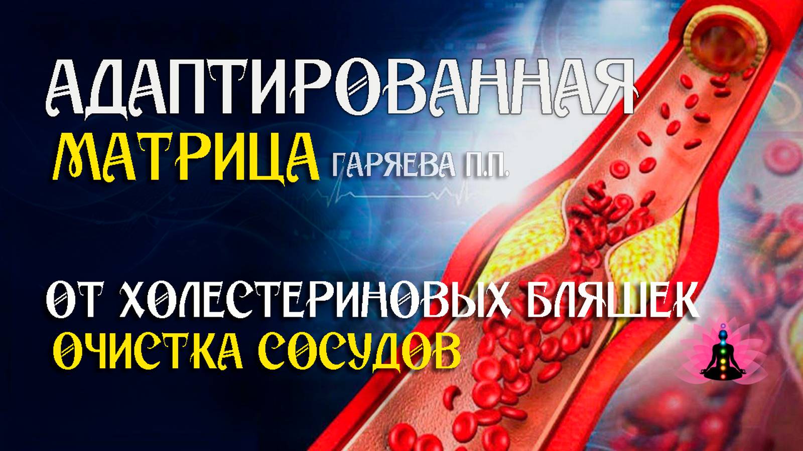 Очистка сосудов от холестериновых бляшек  🌀 Адаптированная матрица Гаряева П.П.  ☀️ SoftRadio.ru
