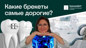 Сапфировые брекеты самые дорогие? Какие выбрать брекеты? 💎|Ваш, ПрезиДЕНТ 💚