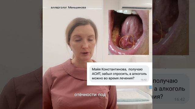 #асит