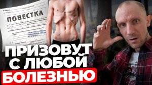 Эти БОЛЕЗНИ уже не спасут от ПРИЗЫВА в армию! Посмотри это пока не поздно...