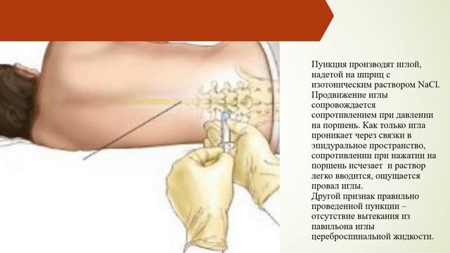 Обезболивания