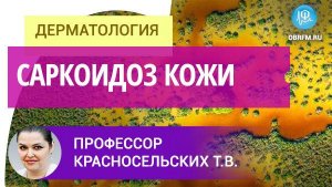 Профессор Красносельских Т.В.: Саркоидоз кожи