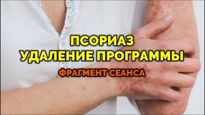 ПСОРИАЗ: УДАЛЕНИЕ ПРОГРАММЫ. СЕАНС ЭНЕРГОЧИСТКИ