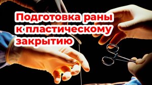 Раневое покрытие Хитокол в комплексе подготовки раны к пластическому закрытию. Цветков В.О.