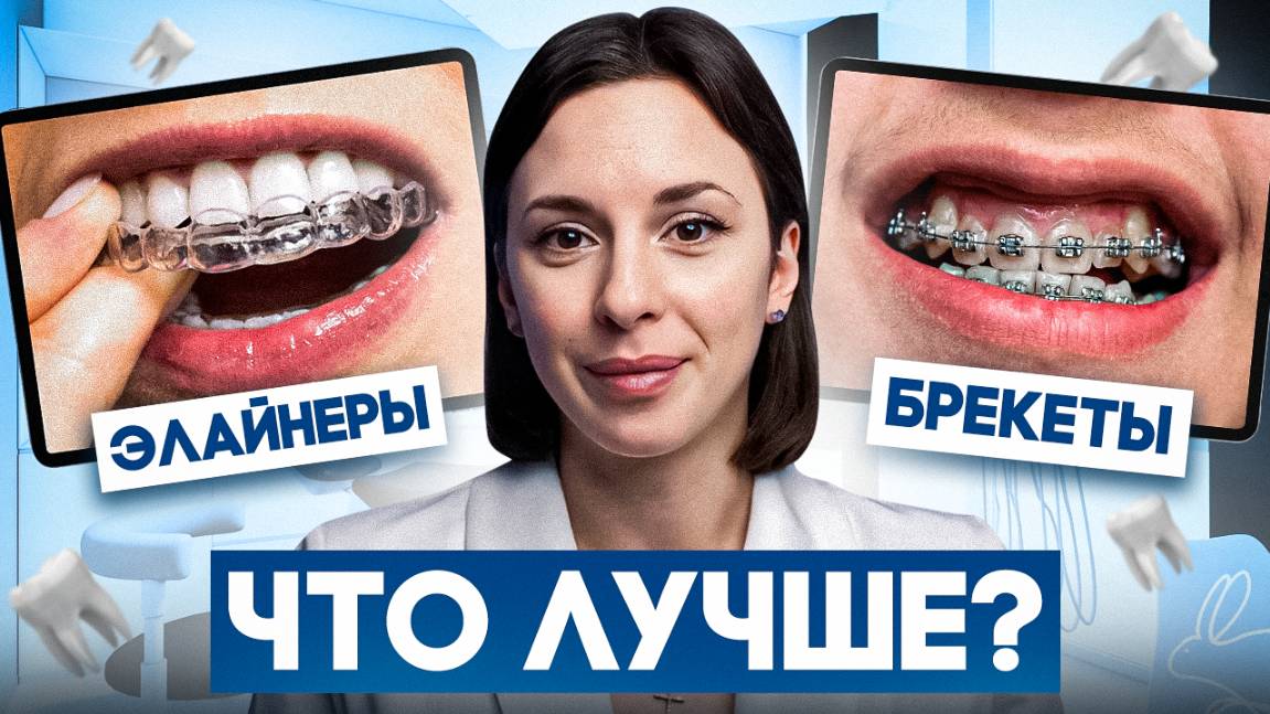 Элайнеры или Брекеты - в чем разница? Что выбрать: Элайнеры VS Брекеты