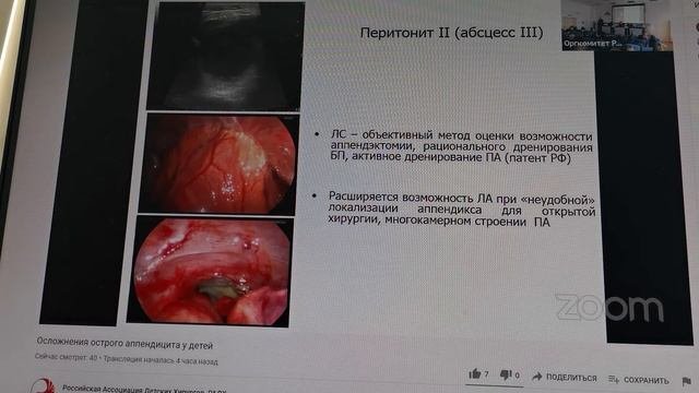 Современные тенденции лечения осложненного аппендицита у детей