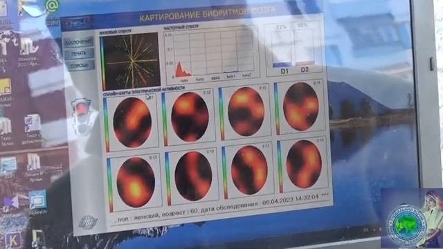 Сакральные музыкальные коды омоложения и безсмертия с приборным замером состояния-Глобальная волна