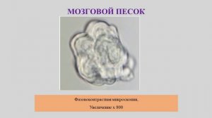 Шматов С.В. Кристалл психической энергии. Структура и состав биогенного минерала