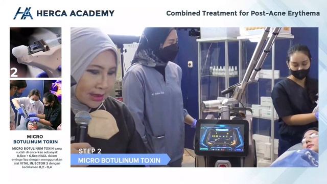 Teaching Class Batch #08 Case Post Acne Erythema - HERCA смотреть онлайн