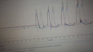 Почему надо ставить свои форсунки на Мазду Премаси FP-DE