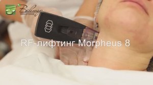 RF-лифтинг Morpheus 8 - косметологическая процедура подтяжки кожи на новейшем аппарате Inmode