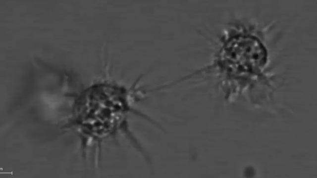 Calcium-dependend aggregation of sea star coelomocytes. смотреть онлайн