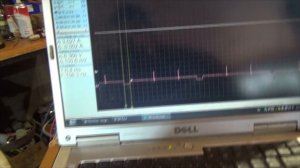 Хёндай Туксон G6BA 2,7 не едет. Любительская постдиагностика.
