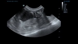 Крупноклеточная лимфома 12-перстной кишки у кошки