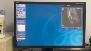 TPS reset procedure on GE HDxt Mri