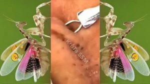 Relax squeezing out blackheads #35 Черные точки