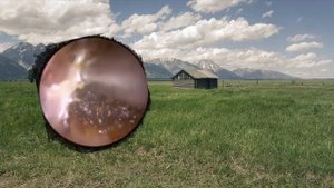 แว๊กซ์หู-Удаление ушной серы-去除耳垢-Ear wax removal.#01