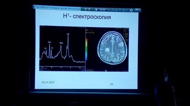 Фокин В.А. – Мультимодальная нейровизуализация: эксперты против знатоков смотреть онлайн