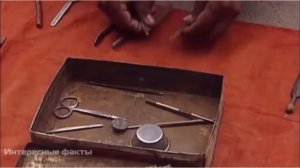 Стоматология в Индии Не для слабонервных Интересные факты