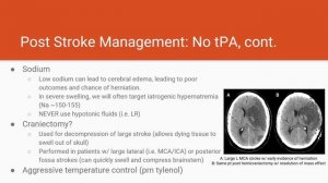 NFTNN Acute Stroke Management part 2