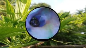 Ear Wax Removal Eps#381 || чистка ушной серы #381