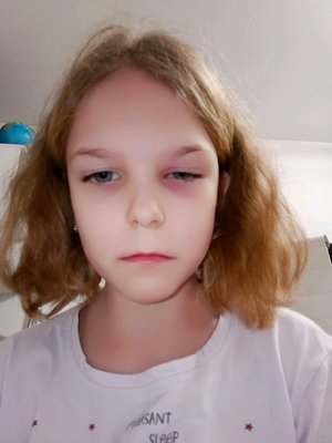 срим1