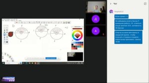 Топографическая анатомия и оперативная хирургия Плечо .Плечевой сустав
