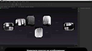 Сравнение нескольких 2D-изображений | DTX Studio Clinic