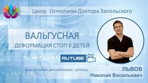 Вальгусная деформация стоп. Врач-остеопат Львов Николай Васильевич