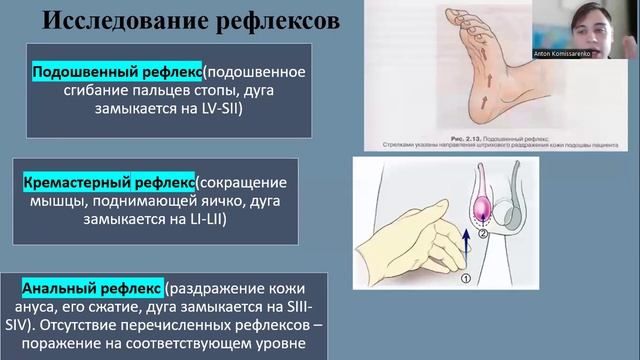 Нарушения движений (парезы и параличи). Неврология. смотреть онлайн