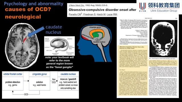 9990 PSYCH  OCD 1 of 2 RE UPLOAD смотреть онлайн