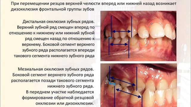 03 Классификация ЗЧА смотреть онлайн