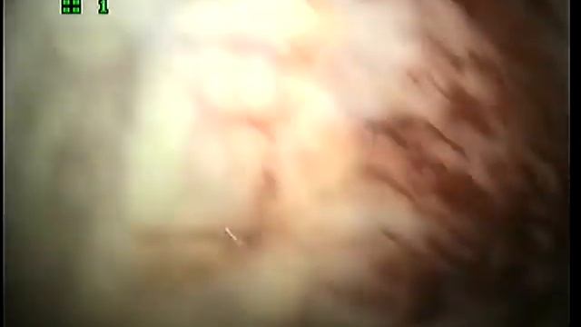 Язва желудка у кошки \ stomach ulcers in cat