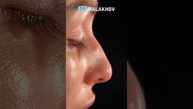 Первичная риносептопластика на операционном столе 🔥