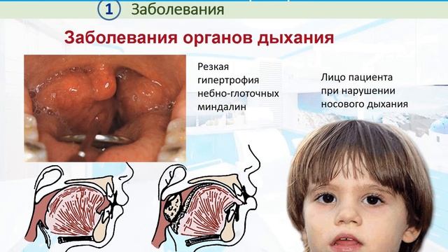 04 Этиология ЗЧА смотреть онлайн