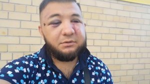 Мразями ПОДЛО ИЗБИТ Гаспар Авакян! Но он продолжает свою деятельность!