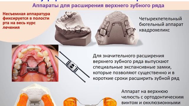5_8б_Аппаратурные_методы_ортодонтического_лечения смотреть онлайн