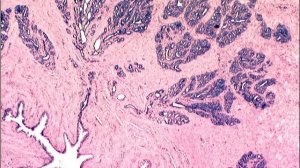 Сазонов С.В. 46. Предстательная железа (простата)