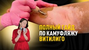 Как избавиться от витилиго. Белые пятна на коже. Решение проблемы.