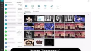 Переназначение группы файлов | DTX Studio Clinic