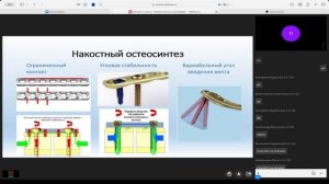 Оперативное лечение переломов. Принципы выбора стабилизации.