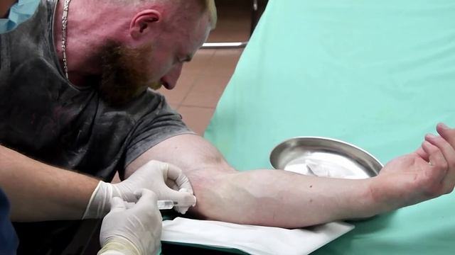 Преодоление Эпикондилита: Введение в мягкие ткани при эпикондилите. Гиал-ин. #ГиалуроноваяКислота