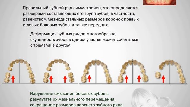 5.1б Аномалии зубных рядов смотреть онлайн