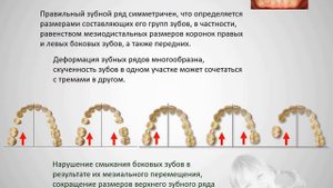 5.1б Аномалии зубных рядов