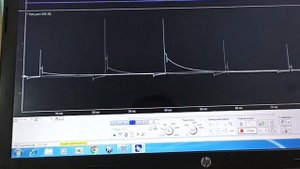 Ваз 2114 пропала тяга, пошаговая диагностика и проверка всех возможных причин.